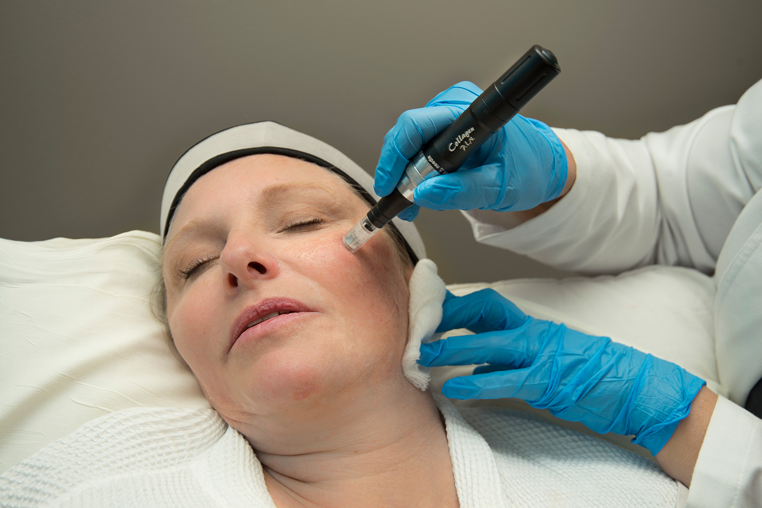 Micro-Needling: Collagen P.I.N.