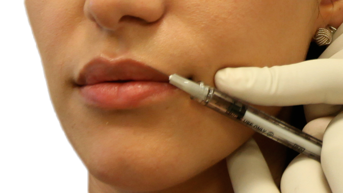 zoom-lips1