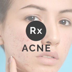 Acne Rx