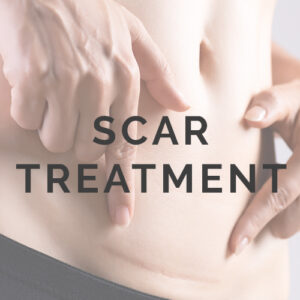 Scar Treatment