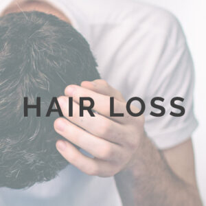 Hairloss